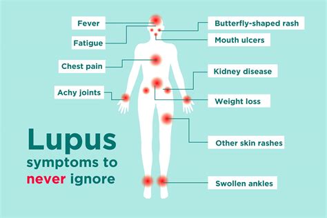 does lupus attack organs.
